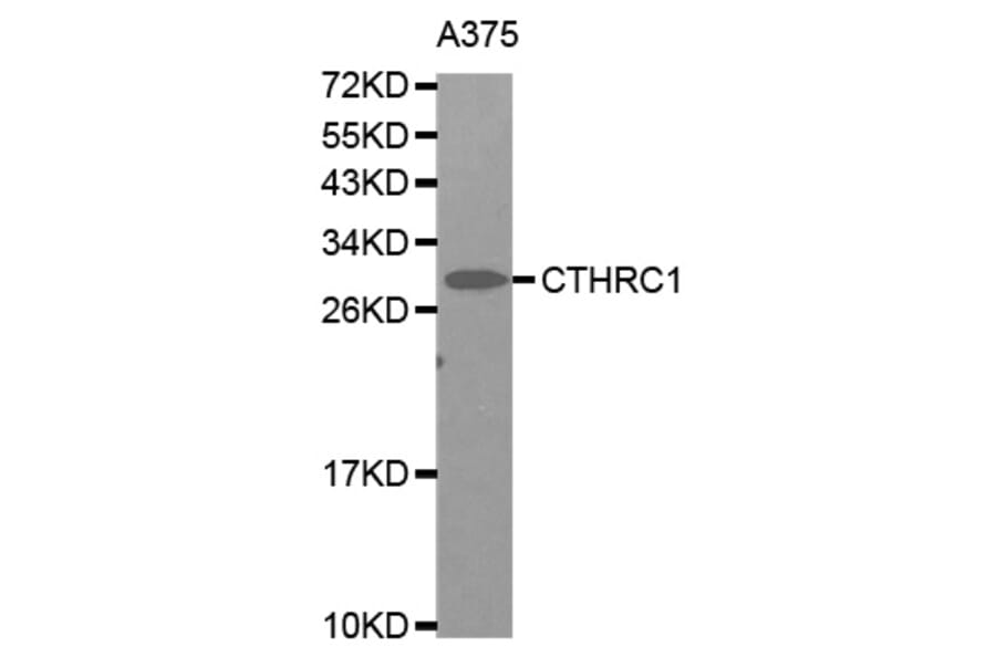Western Blot - Anti-CTHRC1 Antibody (A0940) - Antibodies.com