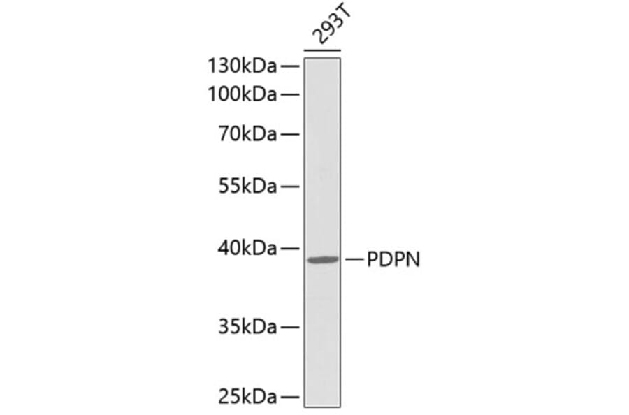 Western Blot - Anti-PDPN Antibody (A0956) - Antibodies.com