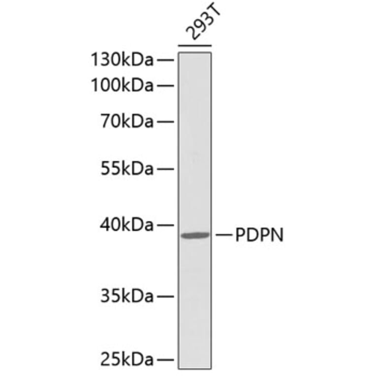 Western Blot - Anti-PDPN Antibody (A0956) - Antibodies.com