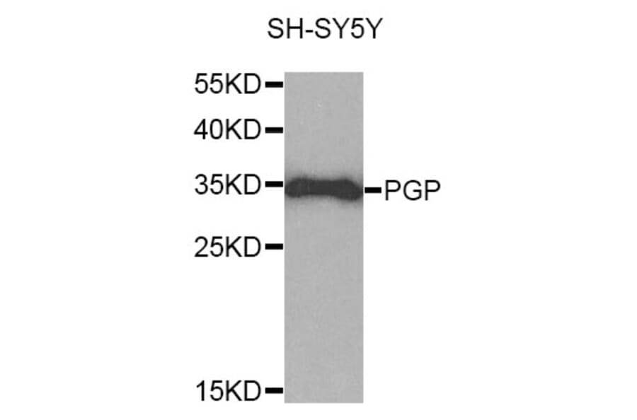 Western Blot - Anti-PGP Antibody (A10002) - Antibodies.com