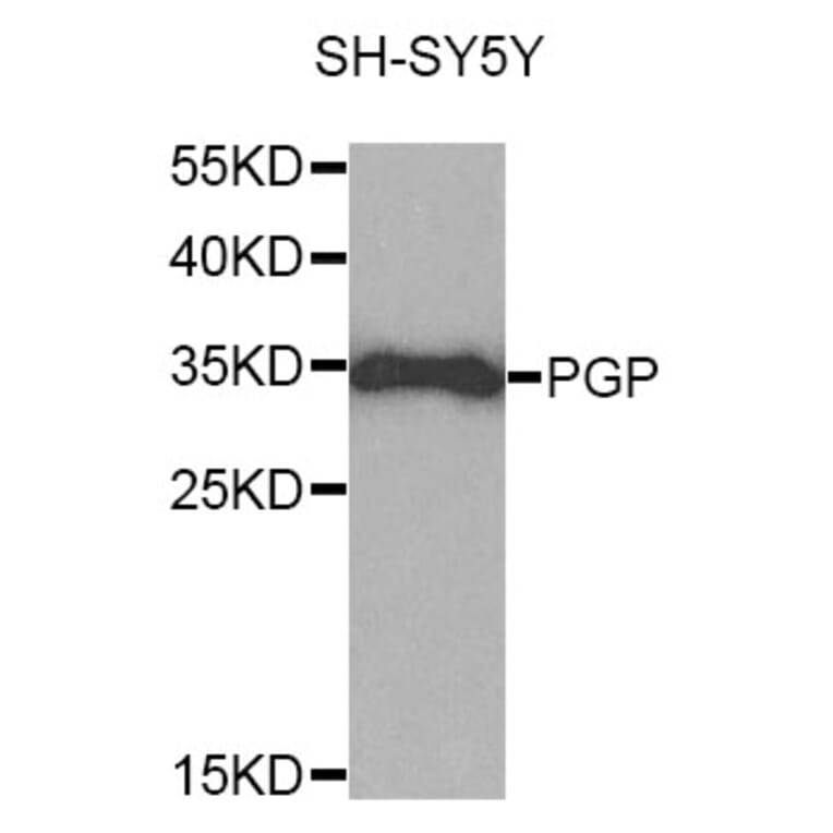 Western Blot - Anti-PGP Antibody (A10002) - Antibodies.com