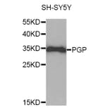 Western Blot - Anti-PGP Antibody (A10002) - Antibodies.com