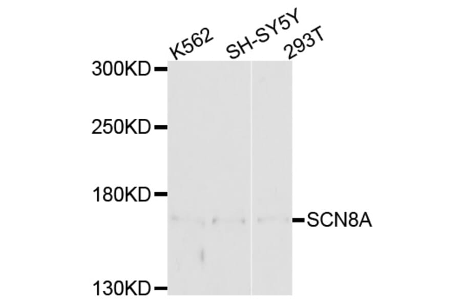Western Blot - Anti-SCN8A Antibody (A10007) - Antibodies.com