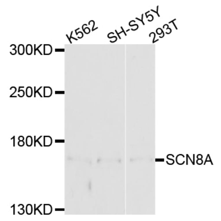 Western Blot - Anti-SCN8A Antibody (A10007) - Antibodies.com