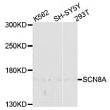 Western Blot - Anti-SCN8A Antibody (A10007) - Antibodies.com