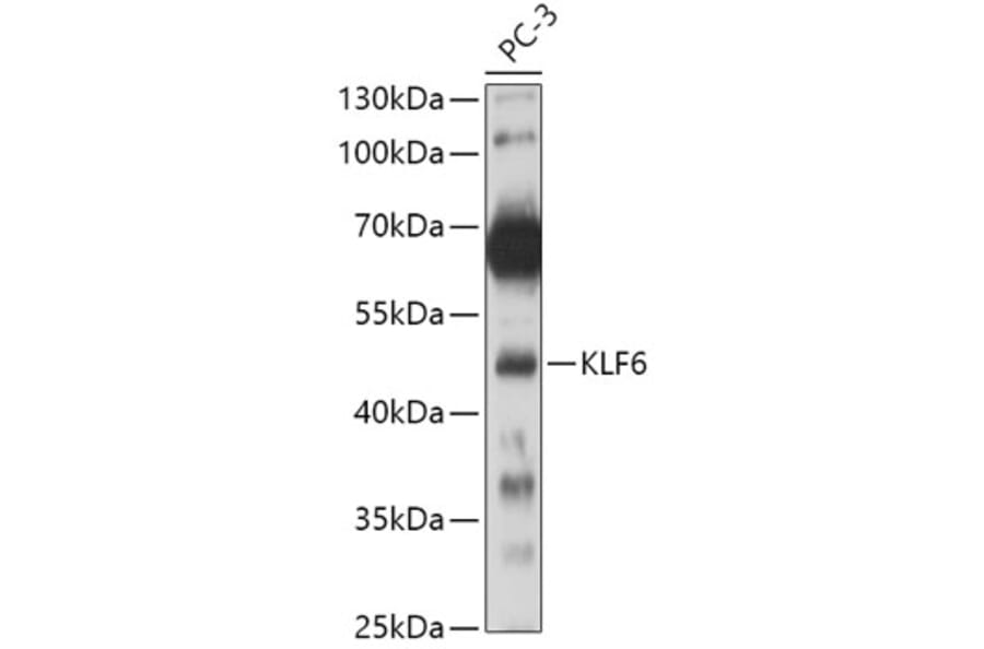 Western Blot - Anti-KLF6 Antibody (A8504) - Antibodies.com