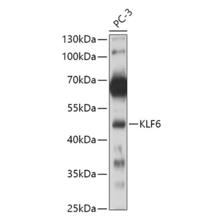 Western Blot - Anti-KLF6 Antibody (A8504) - Antibodies.com