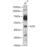 Western Blot - Anti-KLF6 Antibody (A8504) - Antibodies.com