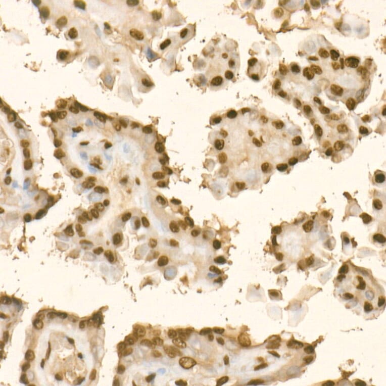 Immunohistochemistry - Anti-KLF6 Antibody (A8504) - Antibodies.com