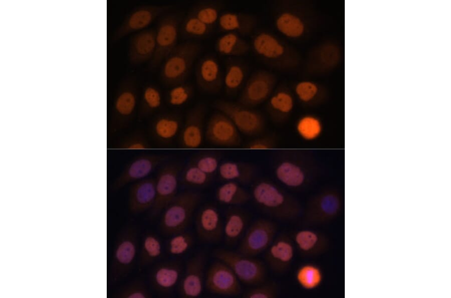 Immunofluorescence - Anti-KLF6 Antibody (A8504) - Antibodies.com