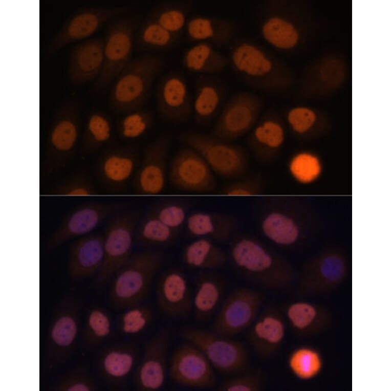 Immunofluorescence - Anti-KLF6 Antibody (A8504) - Antibodies.com