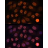 Immunofluorescence - Anti-KLF6 Antibody (A8504) - Antibodies.com