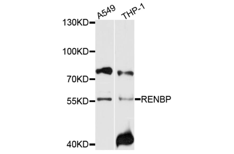 Western Blot - Anti-RENBP Antibody (A10012) - Antibodies.com