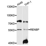 Western Blot - Anti-RENBP Antibody (A10012) - Antibodies.com