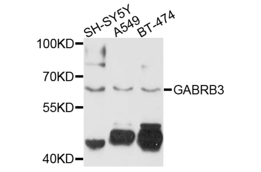 Western Blot - Anti-GABRB3 Antibody (A10015) - Antibodies.com