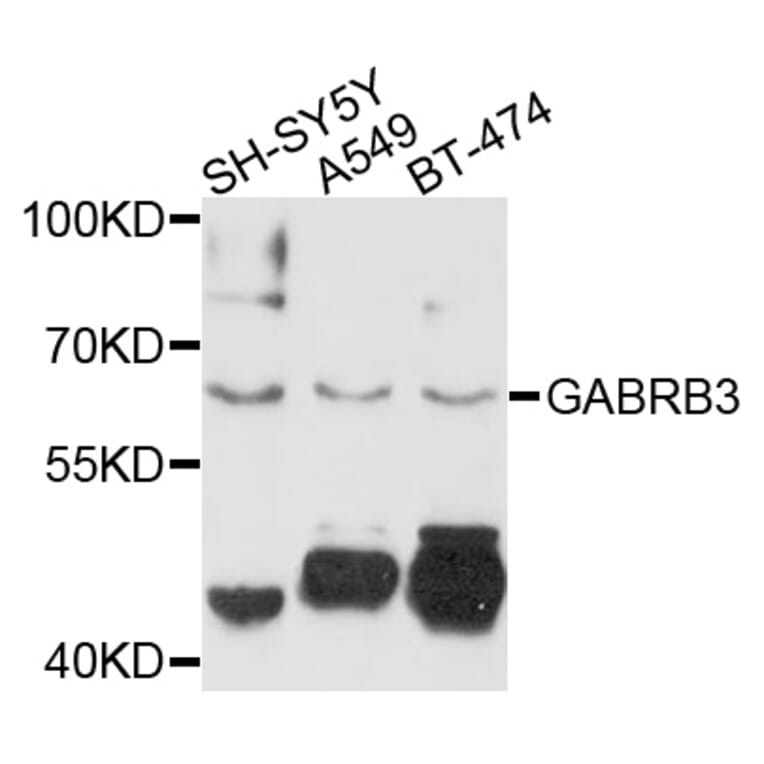 Western Blot - Anti-GABRB3 Antibody (A10015) - Antibodies.com