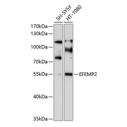 Western Blot - Anti-Fibulin-4 Antibody (A8507) - Antibodies.com