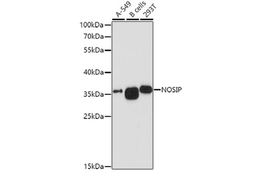 Western Blot - Anti-NOSIP Antibody (A8508) - Antibodies.com