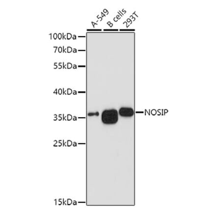 Western Blot - Anti-NOSIP Antibody (A8508) - Antibodies.com
