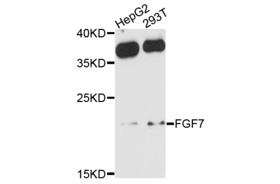 Western Blot - Anti-FGF7 Antibody (A10028) - Antibodies.com