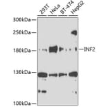 Western Blot - Anti-INF2 Antibody (A10038) - Antibodies.com