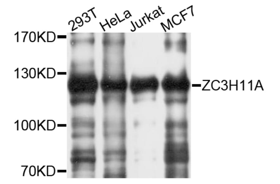 Western Blot - Anti-ZC3H11A Antibody (A10044) - Antibodies.com