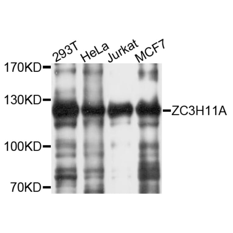 Western Blot - Anti-ZC3H11A Antibody (A10044) - Antibodies.com