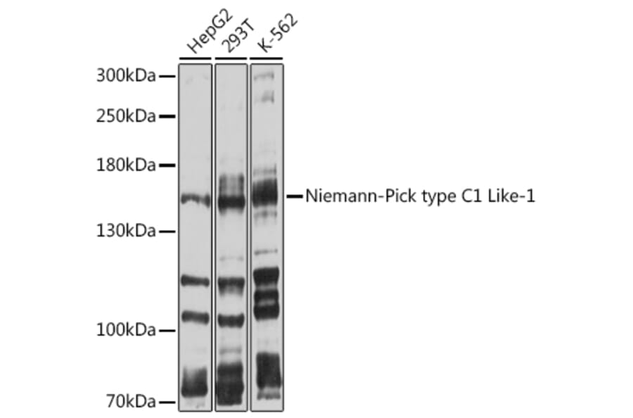 Western Blot - Anti-Niemann Pick C1 Like 1/NPC1L1 Antibody (A8514) - Antibodies.com