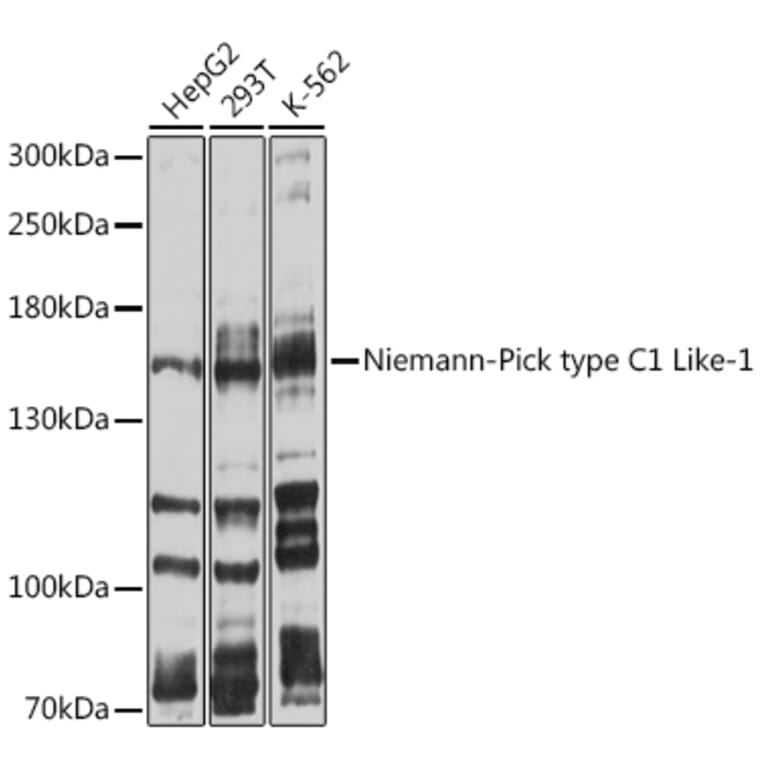 Western Blot - Anti-Niemann Pick C1 Like 1/NPC1L1 Antibody (A8514) - Antibodies.com