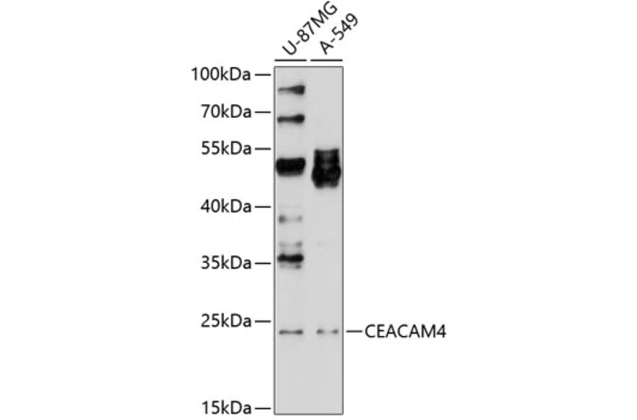 Western Blot - Anti-pan CEACAM Antibody (A8515) - Antibodies.com