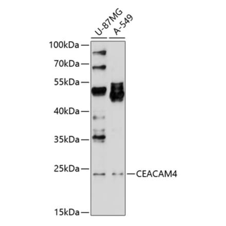 Western Blot - Anti-pan CEACAM Antibody (A8515) - Antibodies.com