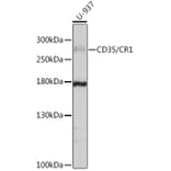 Western Blot - Anti-CD35 Antibody (A8516) - Antibodies.com