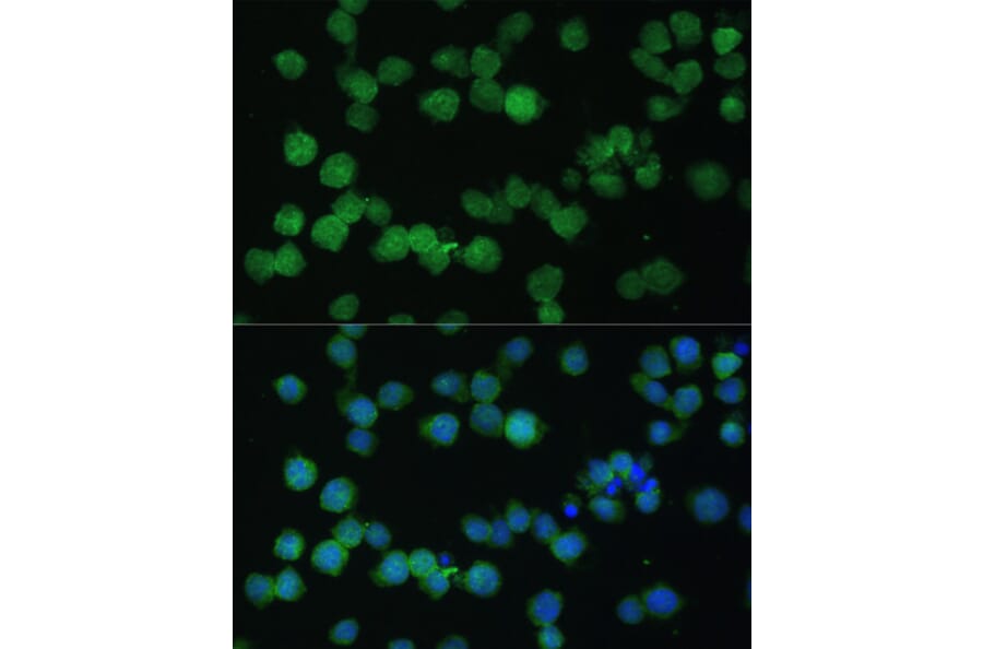 Immunofluorescence - Anti-CD35 Antibody (A8516) - Antibodies.com