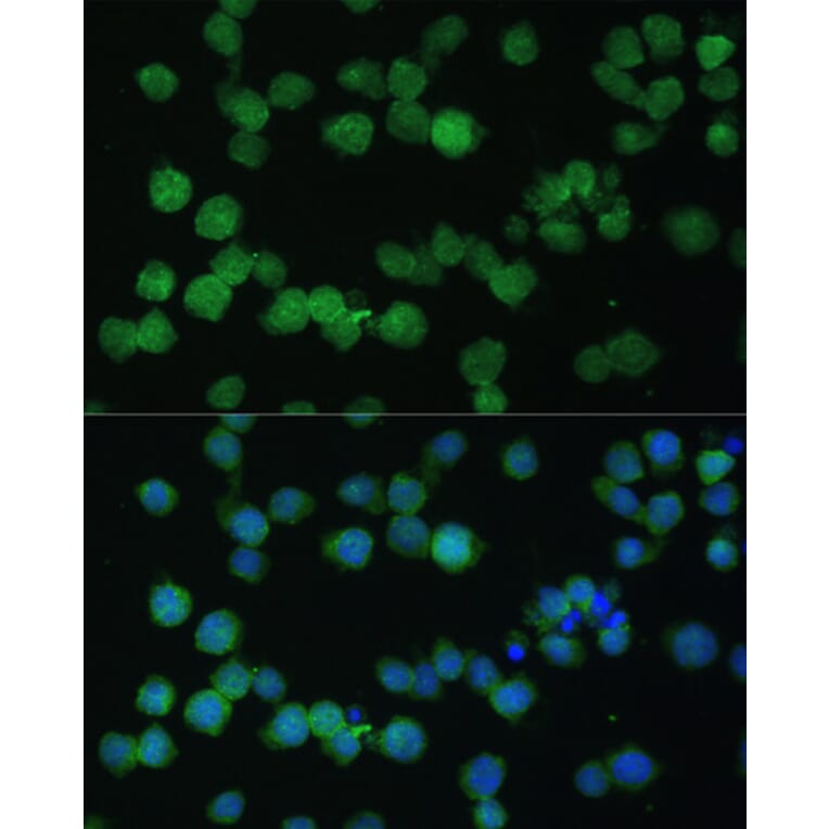 Immunofluorescence - Anti-CD35 Antibody (A8516) - Antibodies.com