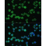 Immunofluorescence - Anti-CD35 Antibody (A8516) - Antibodies.com