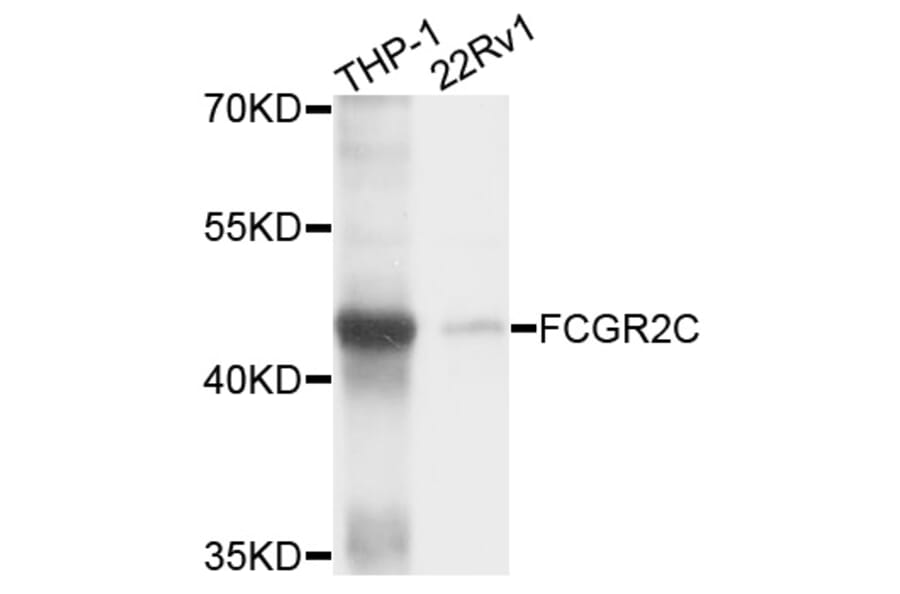 Western Blot - Anti-FCGR2C Antibody (A10062) - Antibodies.com