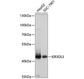 Western Blot - Anti-KIR3DL3 Antibody (A8518) - Antibodies.com