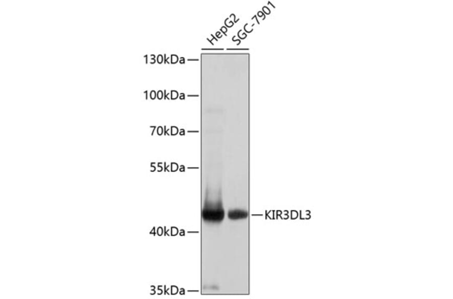 Western Blot - Anti-KIR3DL3 Antibody (A8518) - Antibodies.com