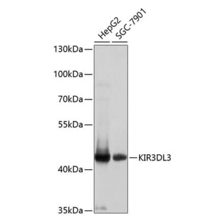 Western Blot - Anti-KIR3DL3 Antibody (A8518) - Antibodies.com