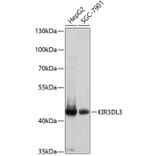 Western Blot - Anti-KIR3DL3 Antibody (A8518) - Antibodies.com