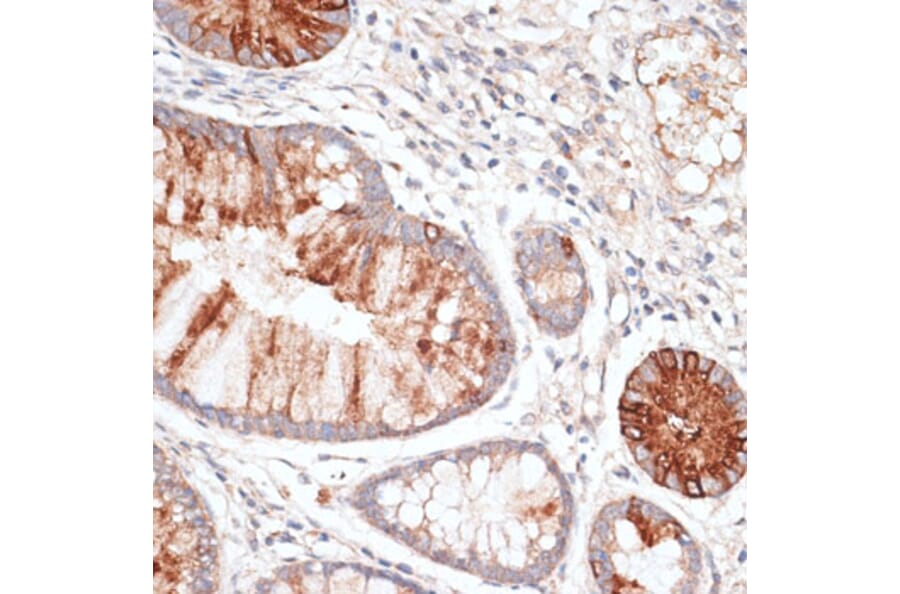 Immunohistochemistry - Anti-KIR3DL3 Antibody (A8518) - Antibodies.com