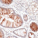 Immunohistochemistry - Anti-KIR3DL3 Antibody (A8518) - Antibodies.com