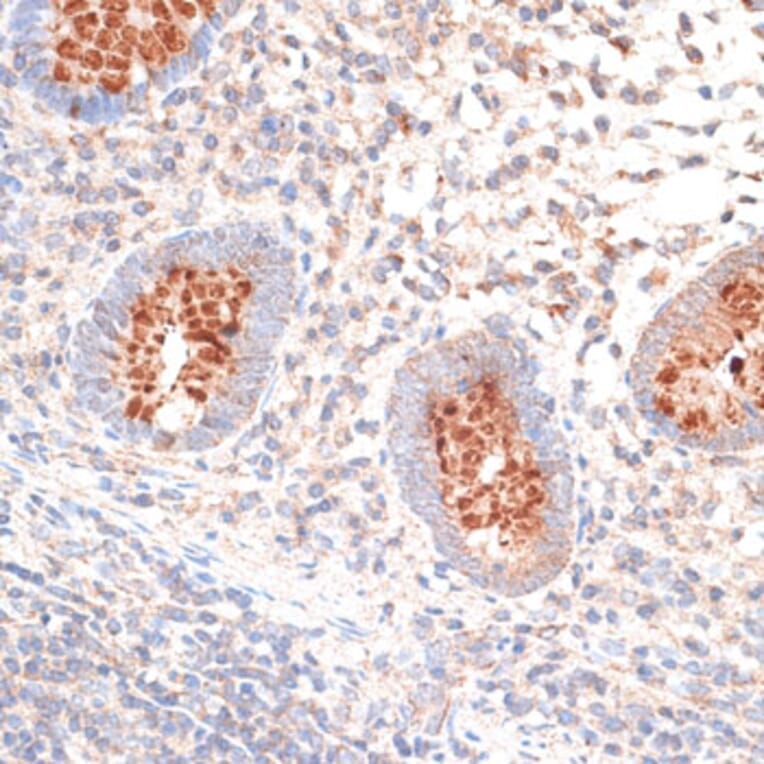 Immunohistochemistry - Anti-KIR3DL3 Antibody (A8518) - Antibodies.com