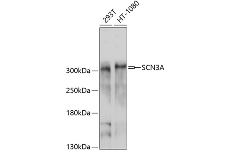 Western Blot - Anti-SCN3A Antibody (A10072) - Antibodies.com