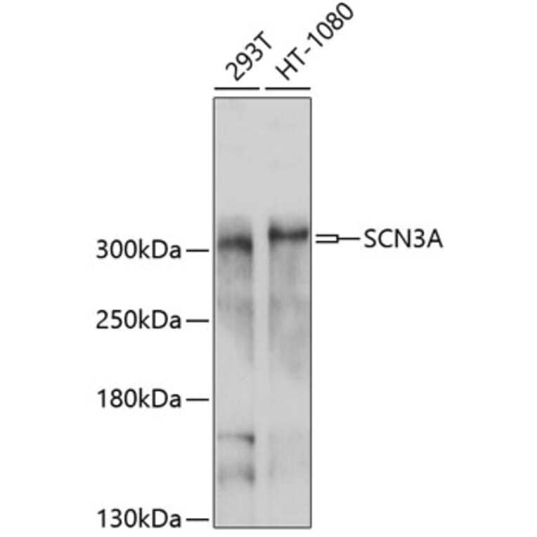 Western Blot - Anti-SCN3A Antibody (A10072) - Antibodies.com