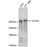 Western Blot - Anti-SCN3A Antibody (A10072) - Antibodies.com