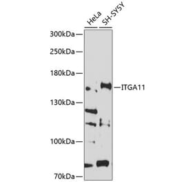 Western Blot - Anti-ITGA11 Antibody (A8521) - Antibodies.com