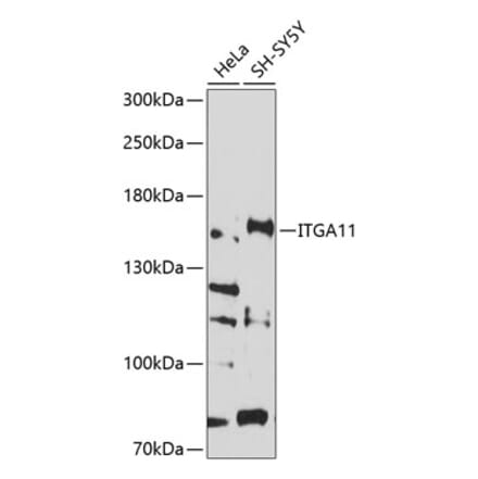 Western Blot - Anti-ITGA11 Antibody (A8521) - Antibodies.com