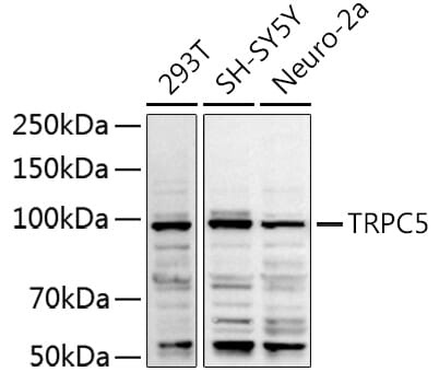Western blot analysis of extracts of SH-SY5Y cells, using Anti-TRPC5 Antibody (A10089) at 1:2000 dilution.
Secondary antibody: Goat Anti-Rabbit IgG (H+L) (HRP) (AS014) at 1:10,000 dilution.
Lysates / proteins: 25µg per lane.
Blocking buffer: 3% non-fat dry milk in TBST.
Detection: ECL Basic Kit (RM00020).
Exposure time: 90s.