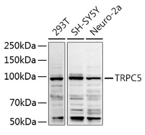 Western Blot - Anti-TRPC5 Antibody (A8522) - Antibodies.com